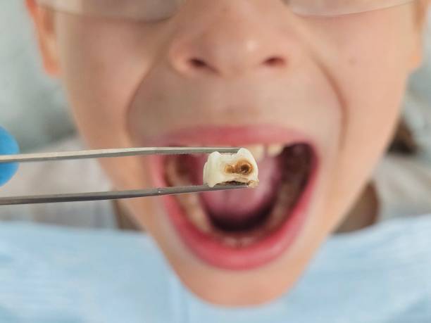 Best Knocked-Out Tooth Emergency  in Stedman, NC